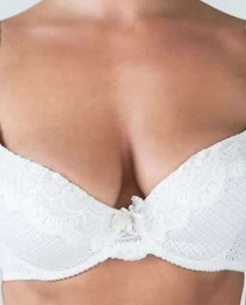 ASIMETRIJA DOJKI – KAKO JE KORIGOVATI?