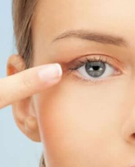 SKINITE UMOR SA LICA I REŠITE SE SPUŠTENIH KAPAKA ZAUVEK