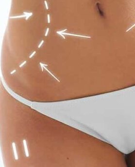 BRZO I LAKO DO ZATEGNUTOG I OBLIKOVANOG TELA - TOTAL BODY LIFTING