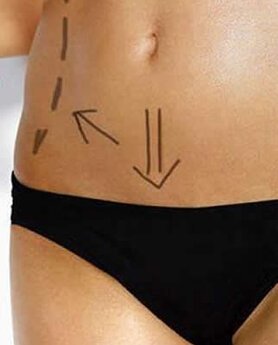 QUICK, EASY, AND SAFE WAY TO A BEAUTIFULLY SCULPTED BODY