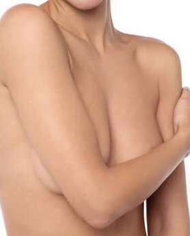 UNEVEN BREASTS – WHEN AND HOW TO CORRECT