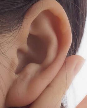 OPERACIJA UŠIJU – VAŠ NOVI IZGLED ZA JEDAN DAN!