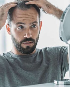 KAKO SE RADI TRANSPLANTACIJA KOSE