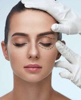 BLEFAROPLASTIKA - PODIZANJE I ZATEZANJE KAPAKA