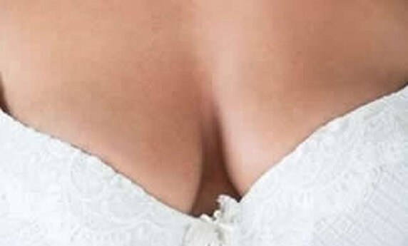 ASIMETRIJA DOJKI – KAKO JE KORIGOVATI?