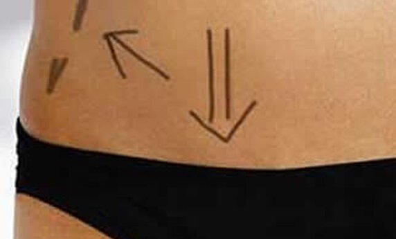 BRZO, LAKO I SIGURNO DO LEPO OBLIKOVANOG TELA