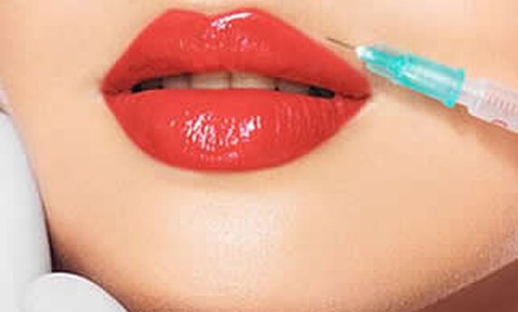 HIJALURONSKI FILERI – SVE ŠTO JE POTREBNO DA ZNAŠ!