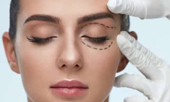 BLEPHAROPLASTY - LIFTING AND TIGHTENING OF THE EYELIDS